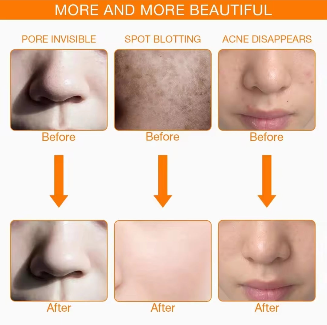 MASCARILLA FACIAL LED